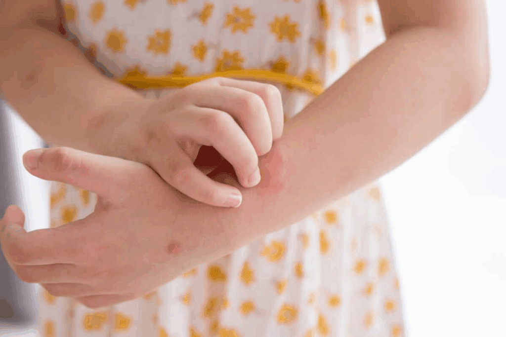 8 Key Signs Of Anemia In Children: Spot Symptoms Early