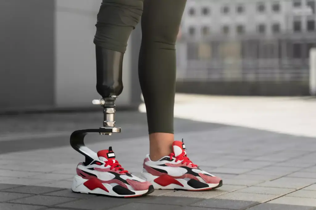 Understanding Smart Knee Implants