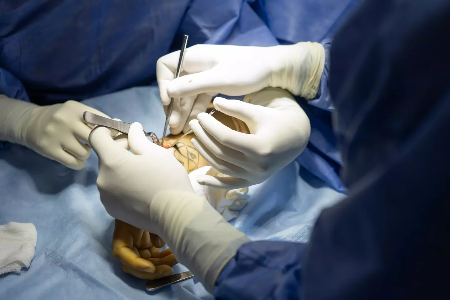 Double Hip Surgery: 7 Key Facts About Bilateral Hip Replacement 1 Double Hip Surgery: 7 Key Facts About Bilateral Hip Replacement