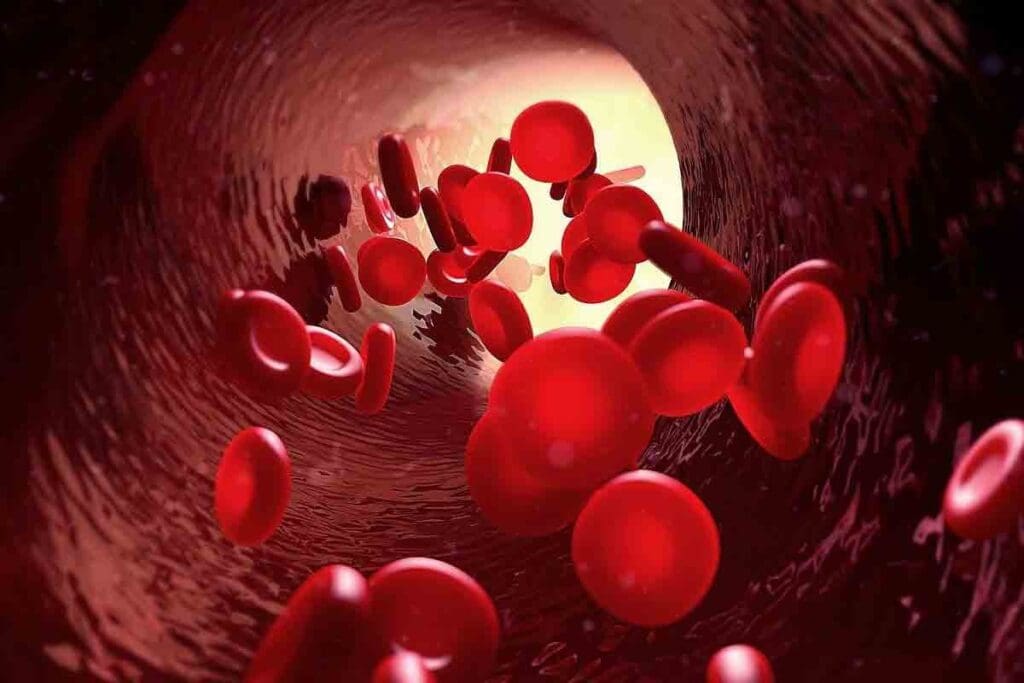 Thalassemia Carrier Symptoms and Signs