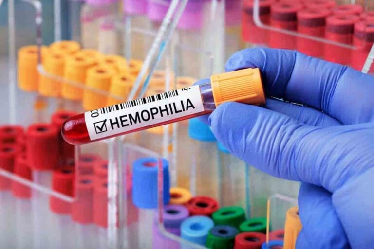 What is the new treatment for hemophilia?