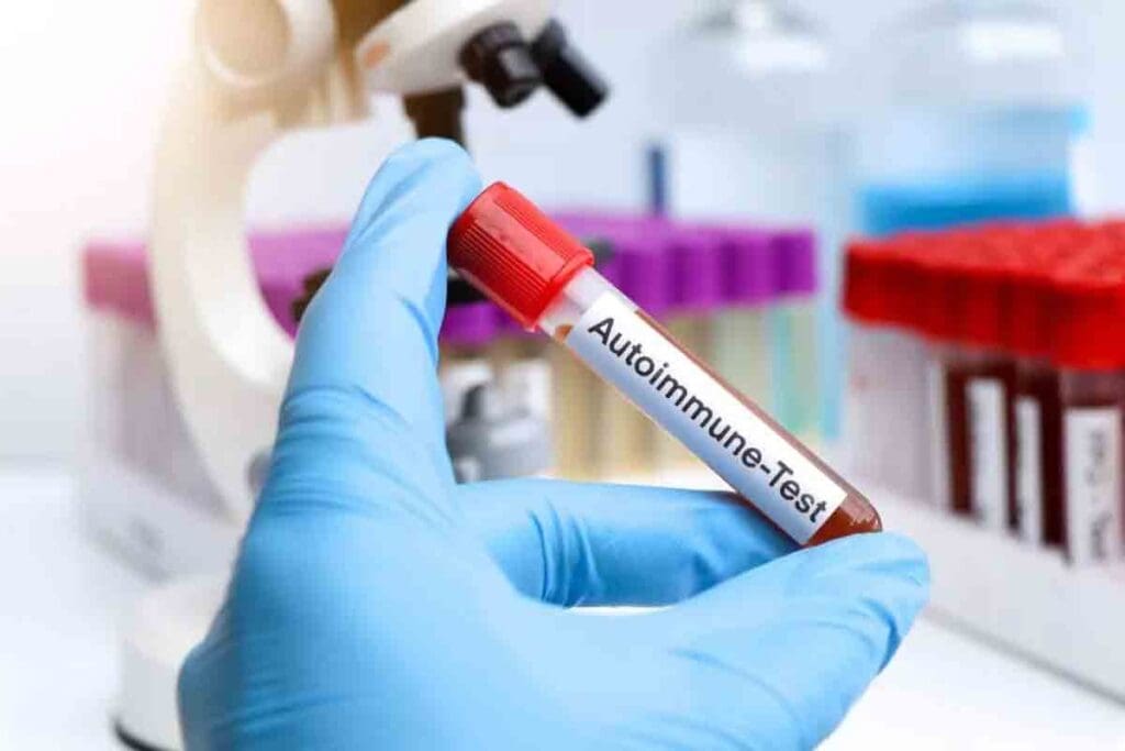 Autoimmune Disease Iron Deficiency: 7 Key Facts 3 Autoimmune Disease Iron Deficiency: 7 Key Facts