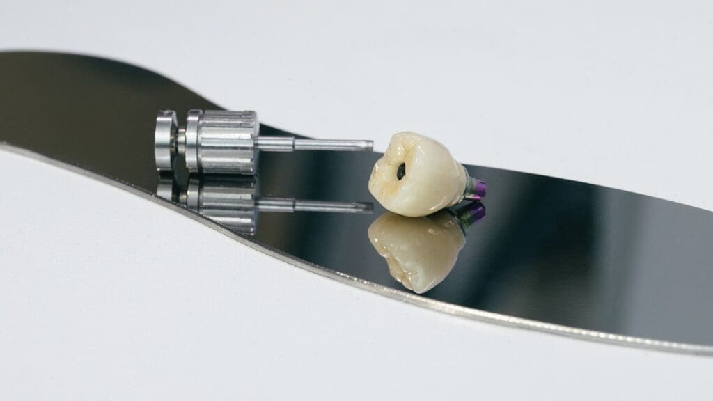 Hip Prosthesis Materials