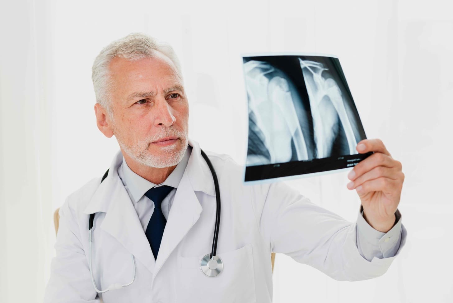 7 Key Facts About Total Shoulder Replacement X-Rays with Anatomic Implants