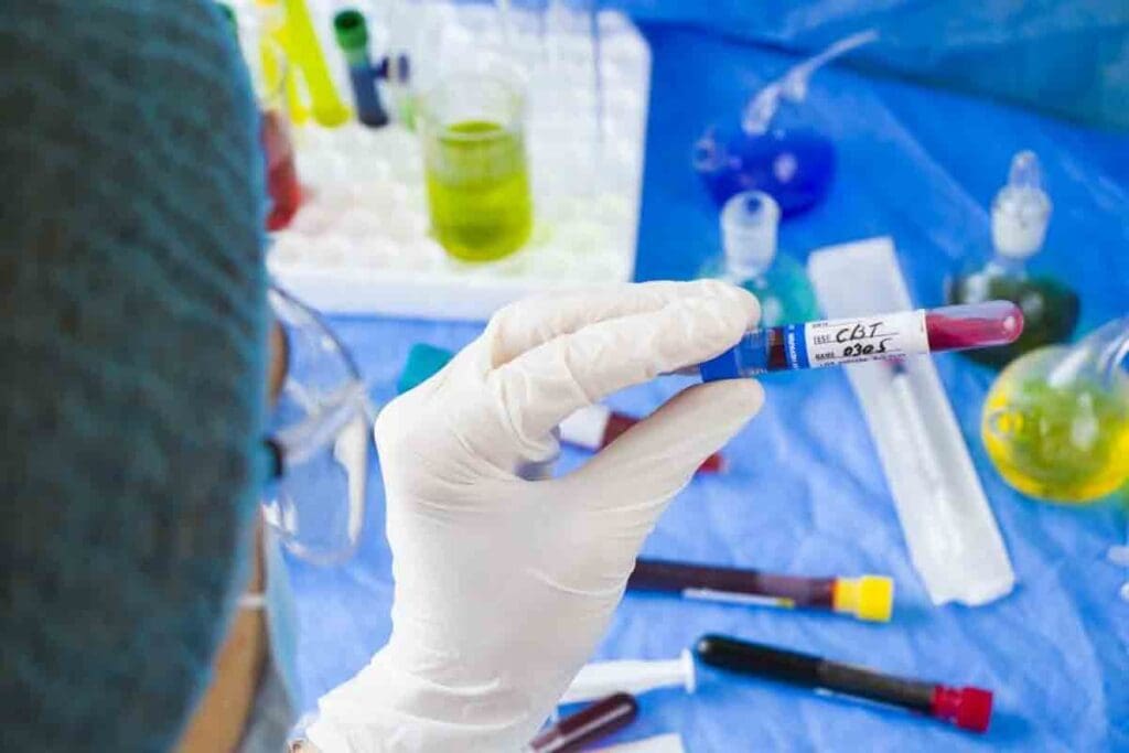 CBC Of Aplastic Anemia: 7 Key Lab Findings 3 CBC Of Aplastic Anemia: 7 Key Lab Findings