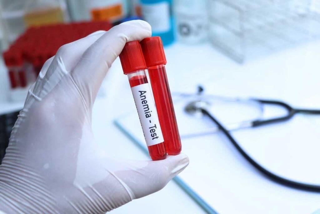 Aplastic Anemia Blood Test Results: 7 Key Findings