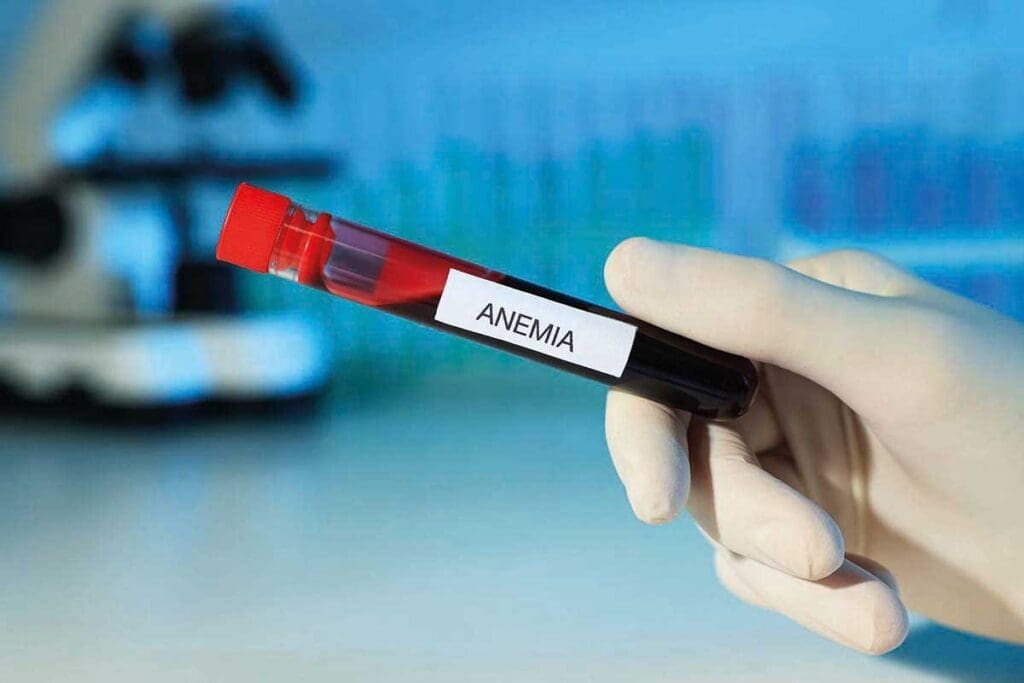 Aplastic Anemia Blood Test Results: 7 Key Findings