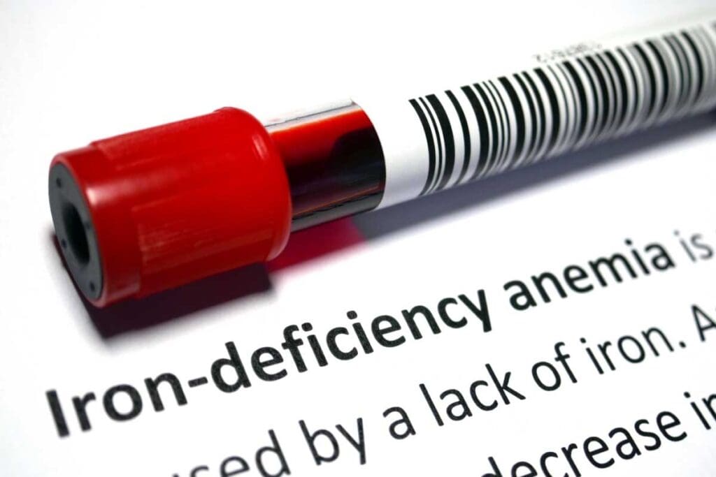 Low Iron And Fever: Crucial Symptoms & Treatments 2 Low Iron And Fever: Crucial Symptoms & Treatments