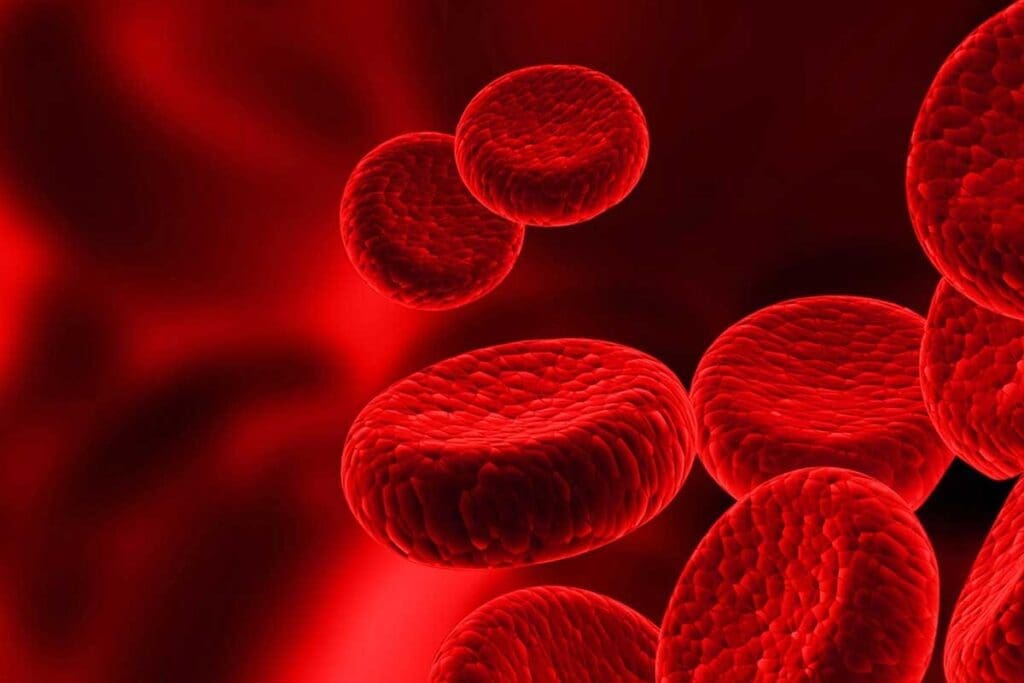 Unexplained Anemia: 8 Crucial Causes in the Elderly 2 Unexplained Anemia: 8 Crucial Causes in the Elderly