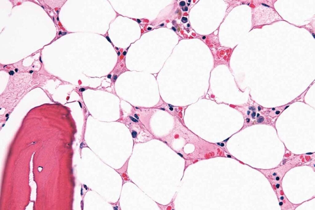 Cure Rate Childhood Leukemia: 7 Amazing Facts to Know 2 Cure Rate Childhood Leukemia: 7 Amazing Facts to Know