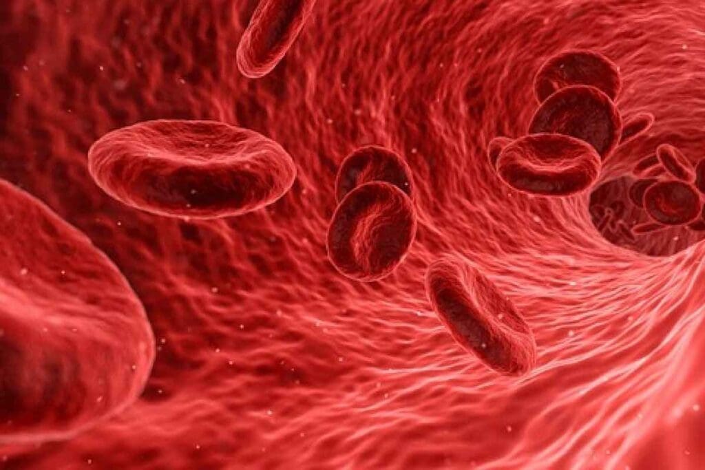 Aplastic Anemia Crisis: 8 Key Facts About Etiology, Blood Film, and Prognosis