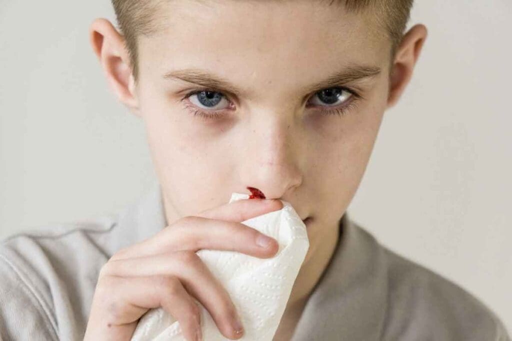 Leukemia Nosebleed: 7 Critical Symptoms to Know 3 Leukemia Nosebleed: 7 Critical Symptoms to Know