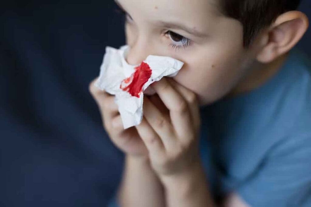 Leukemia Nosebleed: 7 Critical Symptoms to Know 1 Leukemia Nosebleed: 7 Critical Symptoms to Know