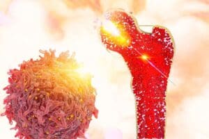 Bone Marrow Transplant vs Stem Cell Transplant: Key Differences You Need to Know