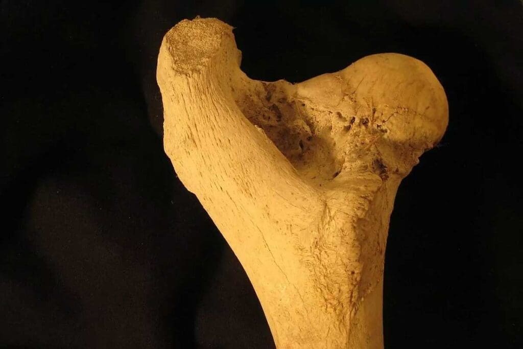 Red vs Yellow Bone Marrow: 7 Key Differences Explained in Bullet Points