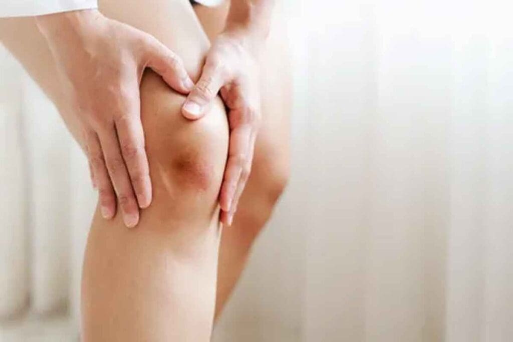 Is It a Deep Vein Thrombosis Bruise or a Blood Clot: How to Tell the Difference?