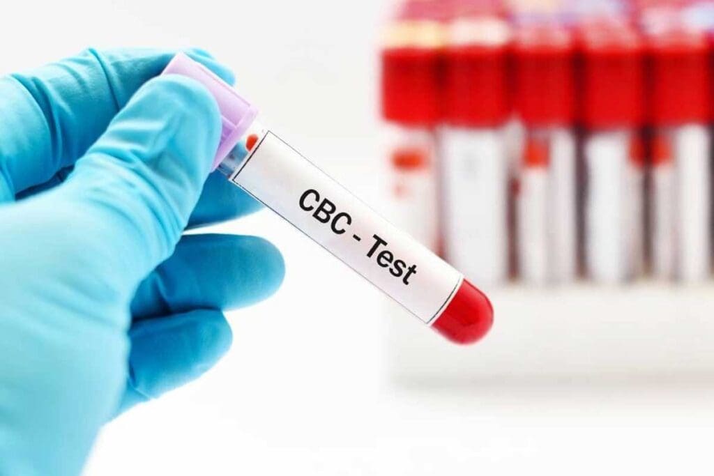 What Can Blood Tests Reveal—and How Do Doctors Use Them for Diagnosis?