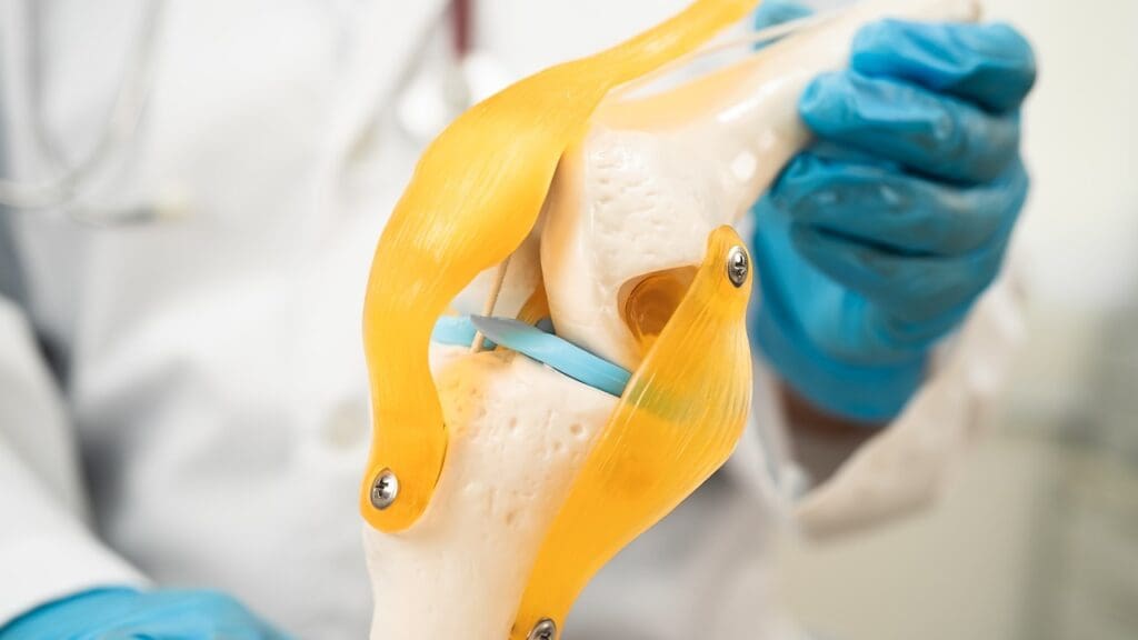 Knee Arthroscopy Surgery