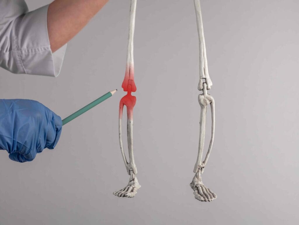 human knee joint showcasing the intricate mechanisms behind non-surgical repair.