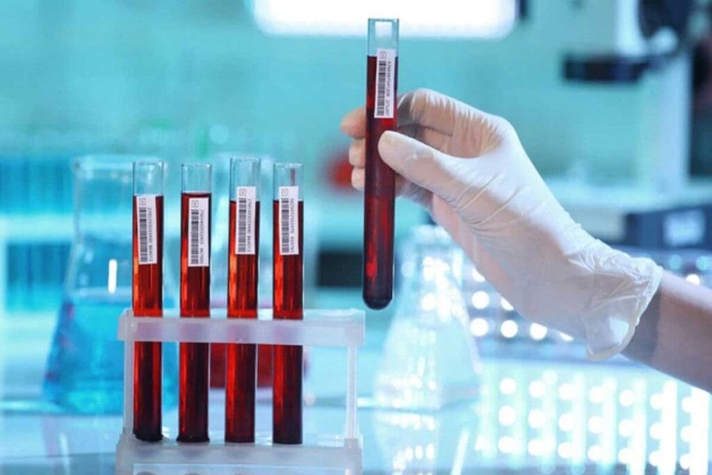 Full Panel Blood Test: 12 Key Markers for General Health Assessment