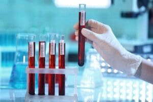 Full Panel Blood Test: 12 Key Markers for General Health Assessment