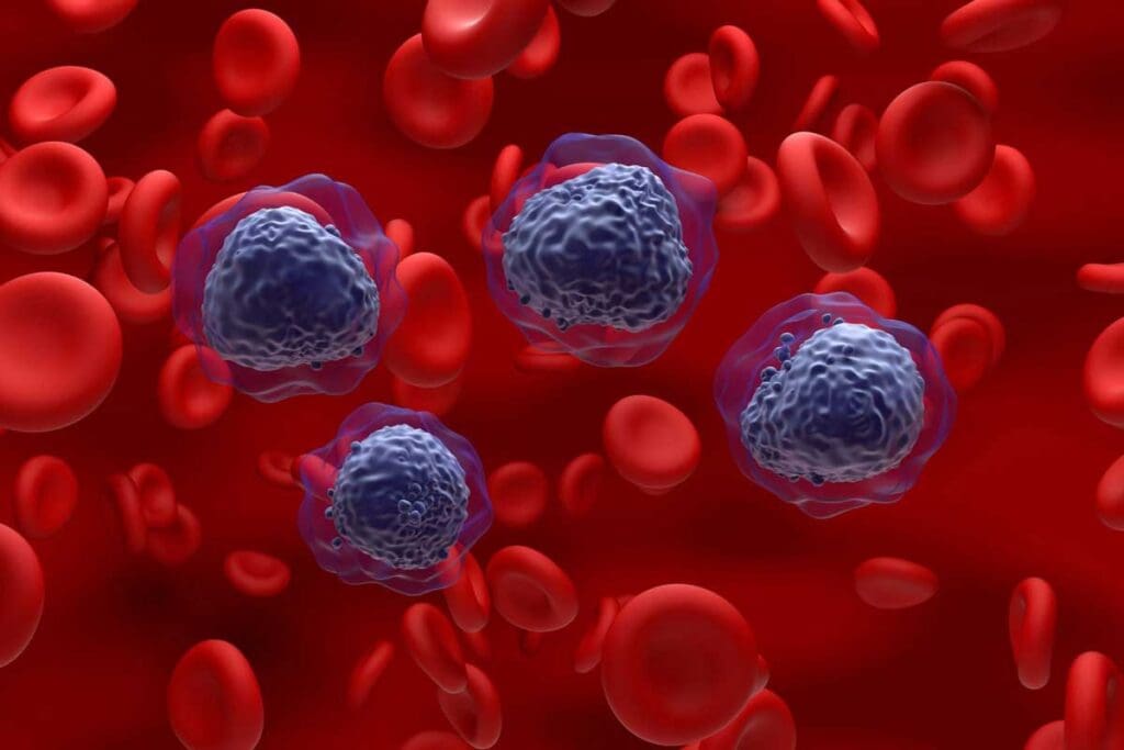 7 Key Facts About Stem Cell Transplant for Multiple Myeloma 3 7 Key Facts About Stem Cell Transplant for Multiple Myeloma