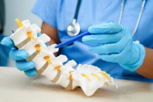 What Is Anterior Lumbar Interbody Fusion (ALIF) and How Does It Work?