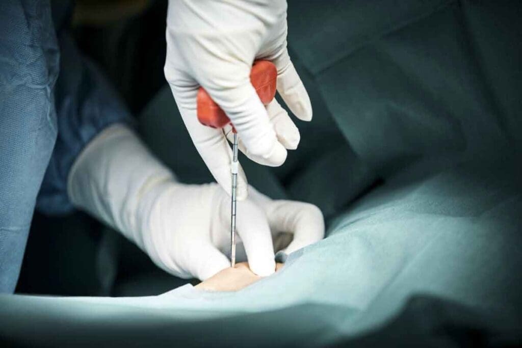 What Is the Bone Marrow Transplant Chemotherapy Protocol and How Does It Work?