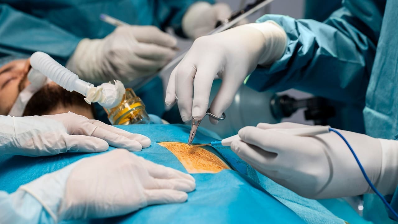 Knee Surgery Arthroscopic Procedures