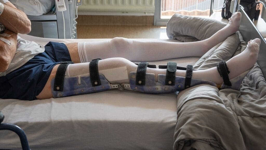 Recovery After Knee Scope Surgery