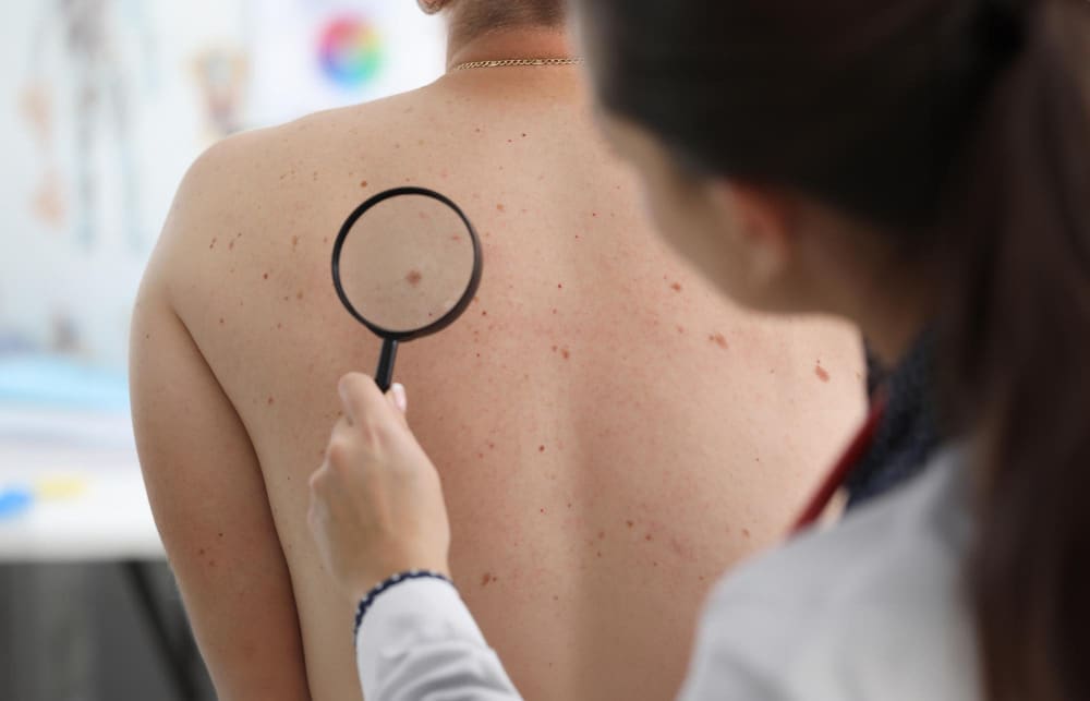 skin cancer diagnosis skin cancer diagnosis
