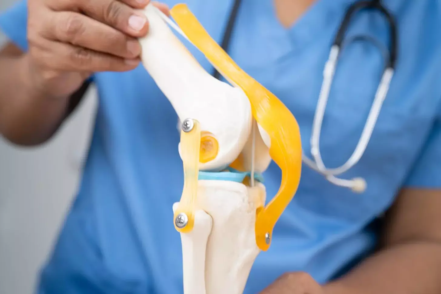 7 Best Artificial Knees and Top-Rated Knee Replacement Devices for 2025