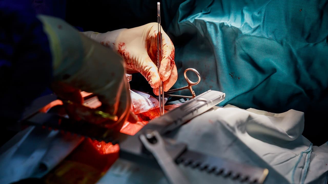 10 Back Surgery Types: Your Guide to Common Spine Procedures