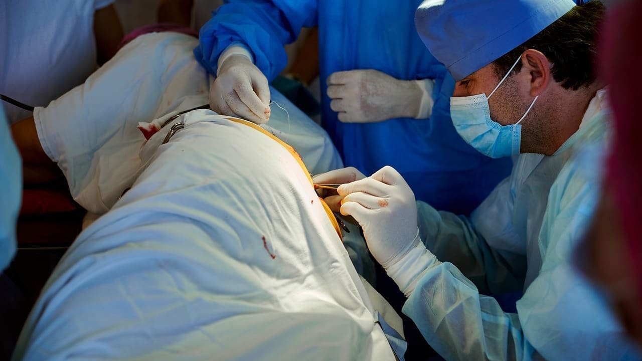 back surgery for pinched nerve