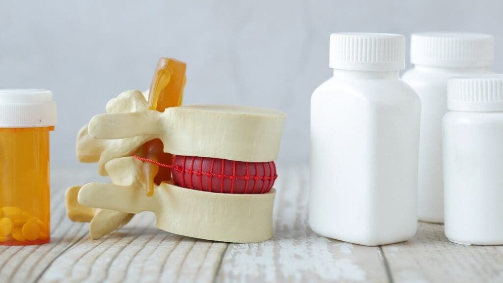 OTC pain relief options