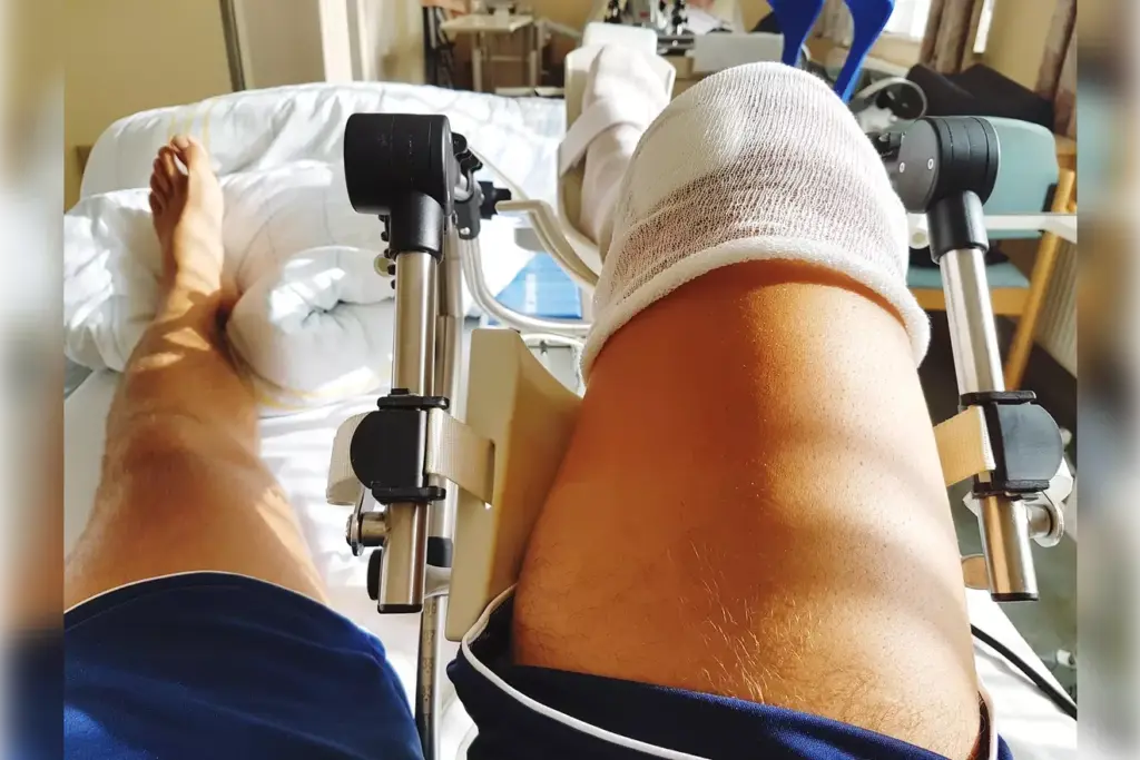 anterior hip replacement recovery time