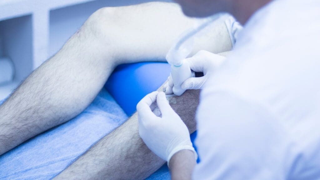 Arthroscopic Knee Surgery Arthroscopic Knee Surgery