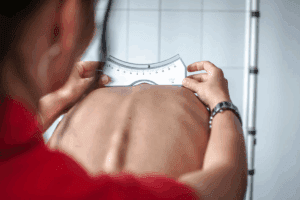 Scoliosis Pain: Where Does the Agony Hurt the Most? Pinpoint the Source