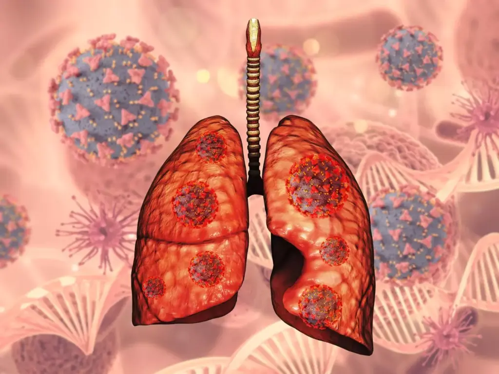 A detailed illustration of non-small cell lung cancer (NSCLC), a type of lung cancer characterized by abnormal cell growth in the lungs. The image shows a cross-section of the lung, with the affected area highlighted in vivid detail. The foreground depicts the malignant cells, their irregular shapes and sizes, and the disruption they cause to the healthy lung tissue. The middle ground showcases the intricate network of airways and alveoli, while the background sets a serene, muted tone, conveying the seriousness of the condition. The lighting is soft and diffused, creating a sense of depth and dimensionality. The overall composition is clean and balanced, inviting the viewer to examine the intricacies of this complex disease.