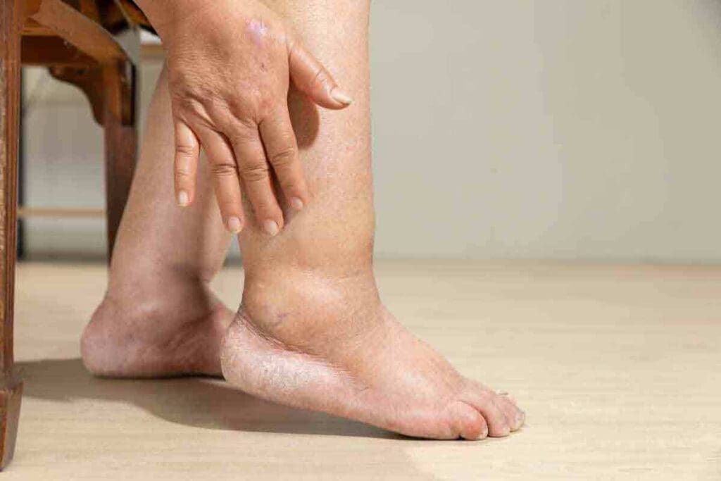 What Kind of Doctor Treats Blood Clots, and How Is Recovery Managed? 3 What Kind of Doctor Treats Blood Clots, and How Is Recovery Managed?