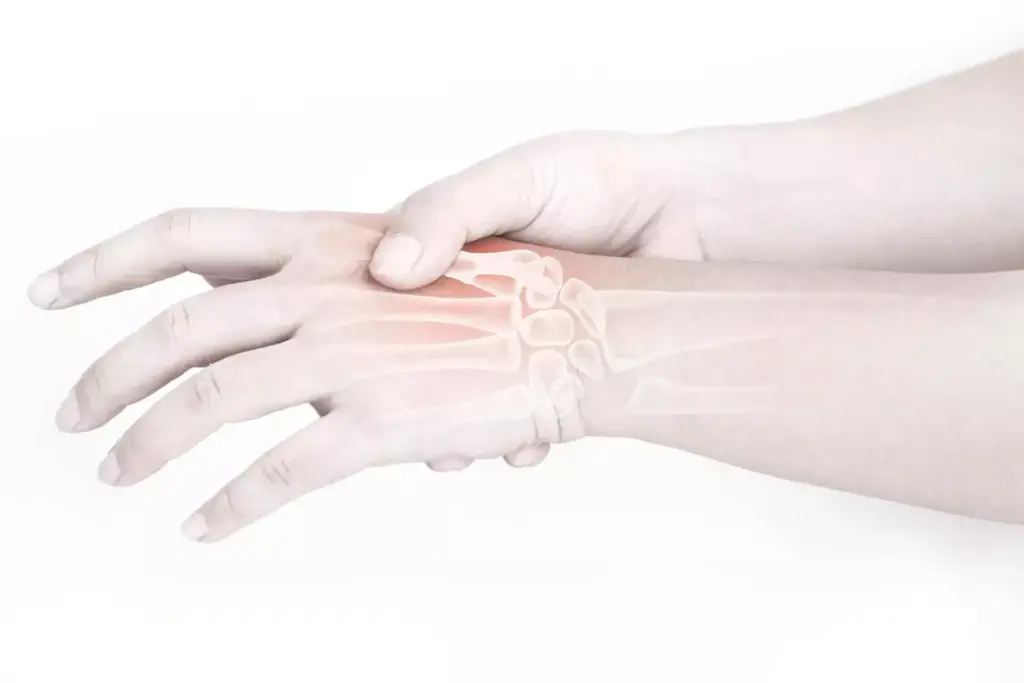 A detailed digital illustration depicting the prevalence of arthritis. A large, realistic human hand in the foreground, with joints and bones clearly visible, showcasing the effects of arthritis. In the middle ground, a world map with regions shaded to represent the global distribution and rates of arthritis, conveying its widespread impact. The background features a soothing, blurred medical/scientific atmosphere, with subtle lighting and a muted color palette to emphasize the informative nature of the image. The overall composition strikes a balance between the personal, individual experience of arthritis and its broader societal implications.