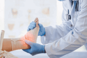 Fracture vs Break: The Ultimate Guide to the Crucial Difference