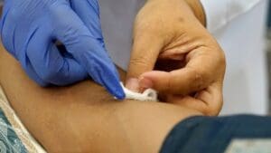 5 Effective Types of Skin Cancer Removal Surgeries Explained