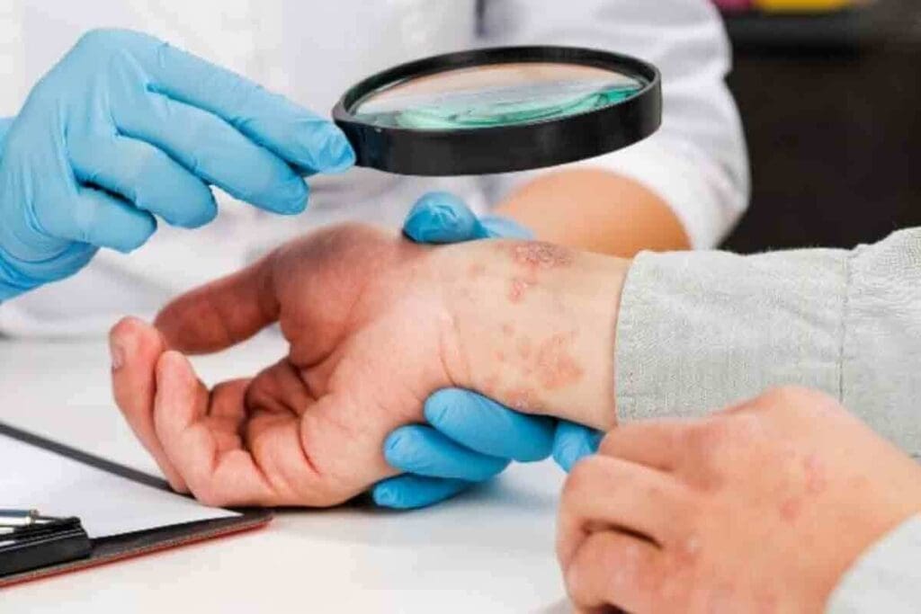 Blood Clot Inside Skin: How to Tell If It’s a Clot or Just a Bruise