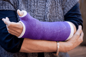 Drugs for Bone Healing: 7 Powerful Options