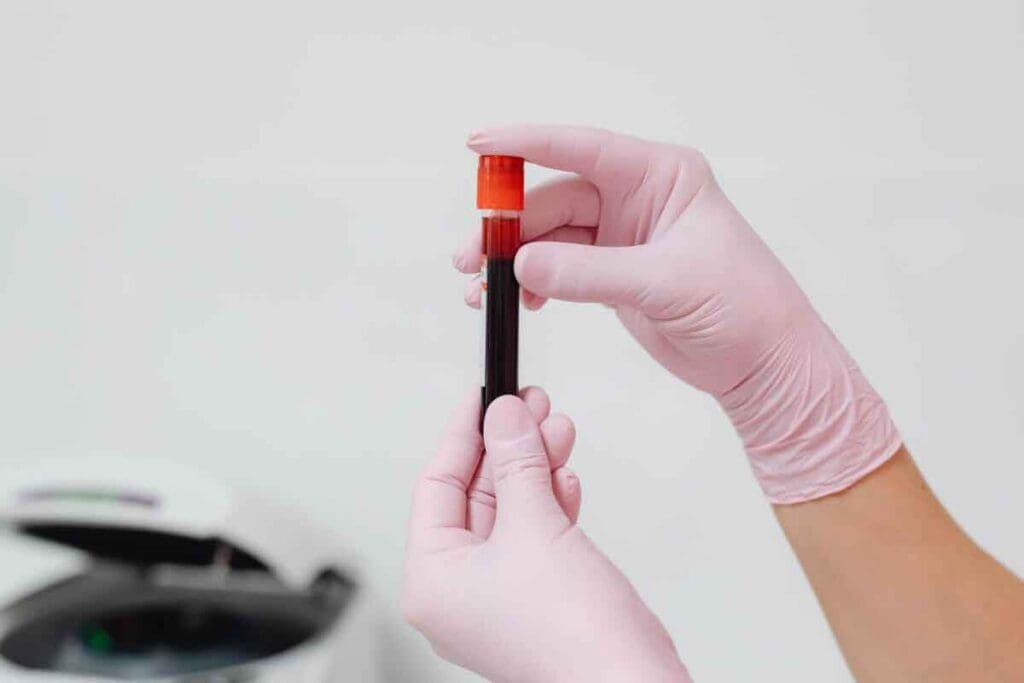 What Does HGB Measure in a Blood Test and Why Is It Important? 2 What Does HGB Measure in a Blood Test and Why Is It Important?