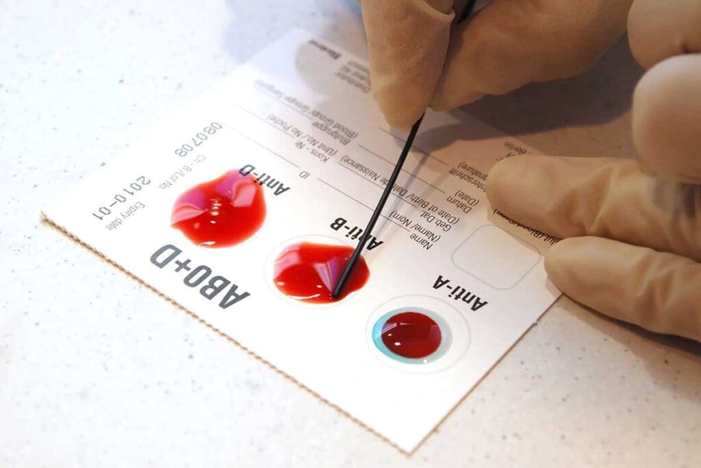 Blood Giving Chart: 8 Essential Blood Type Compatibility Tables