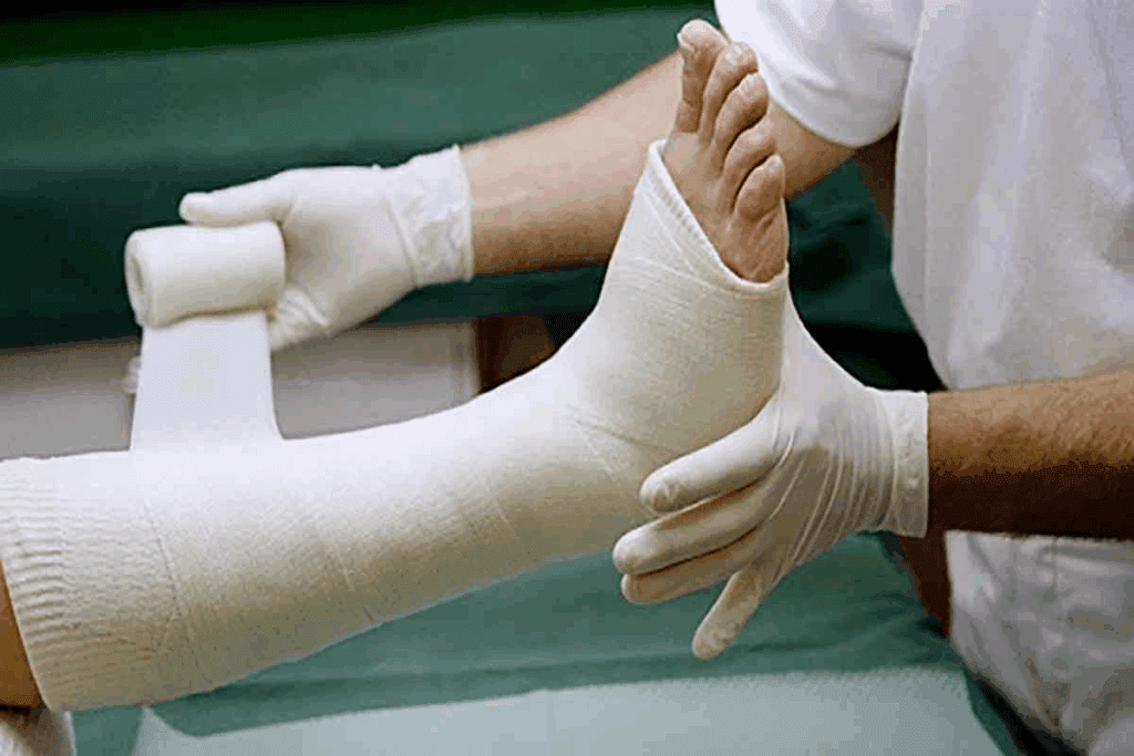 Fracture Healing Time: Your Essential timeline to Faster recovery
