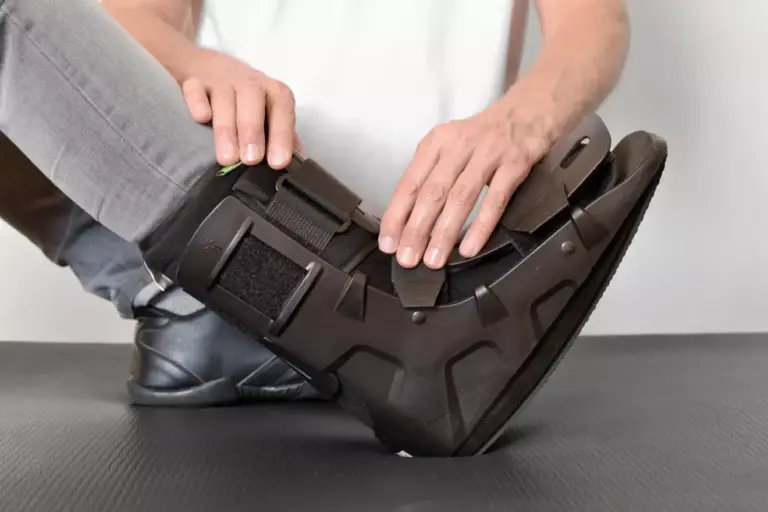 Ankle Implants: Recovery Time, Scars, and What to Expect After Replacement