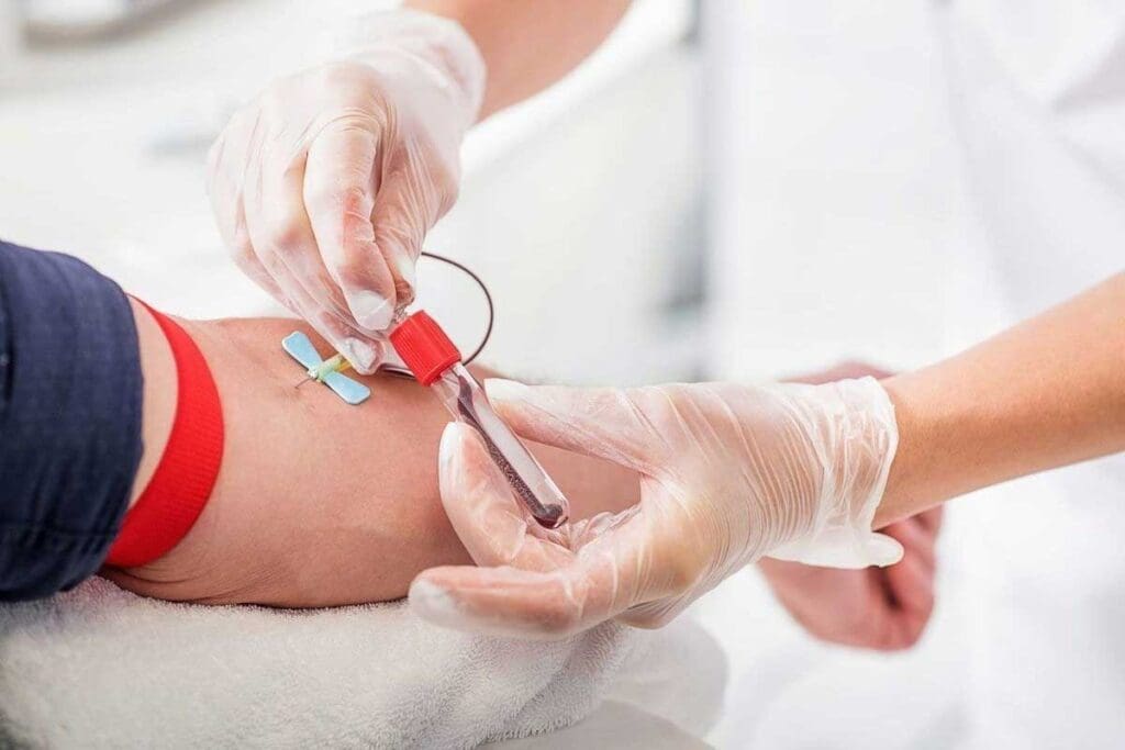 10 Breakthrough Treatment for Blood Cancers in 2025 1 10 Breakthrough Treatment for Blood Cancers in 2025